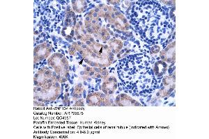 Human kidney (ZNF134 Antikörper  (Middle Region))