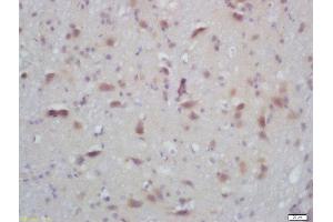 Formalin-fixed and paraffin embedded mouse brain labeled with Rabbit Anti-PKC alpha/beta II (Thr638/641) Polyclonal Antibody, Unconjugated  at 1:200 followed by conjugation to the secondary antibody and DAB staining (PRKCA beta 2 Antikörper  (pThr638, pThr641))