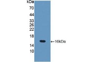 Western blot analysis of recombinant Mouse OCLN. (Occludin Antikörper  (AA 17-107))