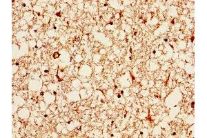 IHC image of ABIN7144427 diluted at 1:1000 and staining in paraffin-embedded human brain tissue performed on a Leica BondTM system. (APOE Antikörper  (AA 21-110))