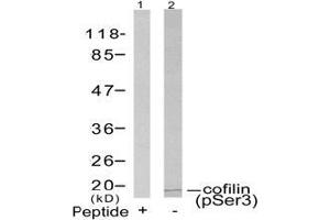 Image no. 3 for anti-Cofilin 1 (CFL1) (pSer3) antibody (ABIN196854) (Cofilin Antikörper  (pSer3))