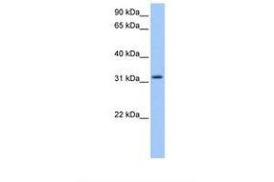 anti-Zinc Finger, C2HC-Type Containing 1C (ZC2HC1C) (AA 93-142) antibody