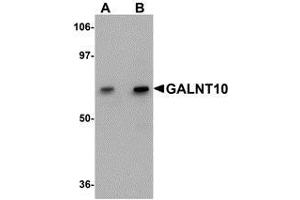Western blot analysis of GALNT10 in SK-N-SH cell lysate with AP30351PU-N GALNT10 antibody at (A) 1 and (B) 2 μg/ml.