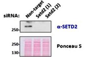 SETD2 polyclonal antibody  (0. (SETD2 Antikörper  (Internal Region))