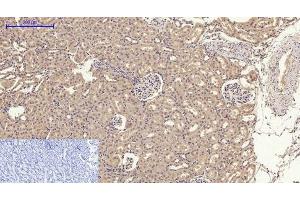 Immunohistochemistry of paraffin-embedded Rat kidney tissue using GLUT-4 Polyclonal Antibody at dilution of 1:200. (GLUT4 Antikörper)