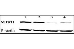 Western blot showing knockdown of endogenous MTM1 expression by MTM1-targeting vectors pD and pD.