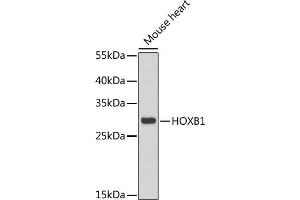 Western blot analysis of extracts of mouse heart, using HOXB1 antibody (ABIN6128032, ABIN6141942, ABIN6141943 and ABIN6222309) at 1:1000 dilution. (HOXB1 Antikörper  (AA 35-180))