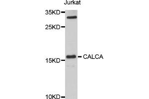 Western blot analysis of extracts of Jurkat cells, using CALCA antibody (ABIN1876765) at 1:1000 dilution. (CGRP Antikörper)