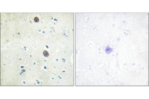 Immunohistochemical analysis of paraffin-embedded human brain tissue using Amyloid β A4 (phospho-Thr743/668) antibody (left)or the same antibody preincubated with blocking peptide (right). (APP Antikörper  (pThr743))