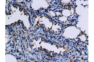 Formalin-fixed and paraffin embedded mouse lung labeled with Anti-TNFSF15/TL1A Polyclonal Antibody, Unconjugated (ABIN709556) followed by conjugation to the secondary antibody and DAB staining