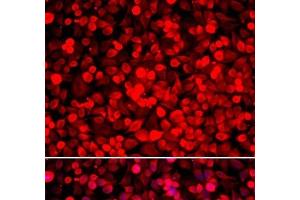 Immunofluorescence analysis of HeLa cells using PUF60 Polyclonal Antibody (PUF60 Antikörper)
