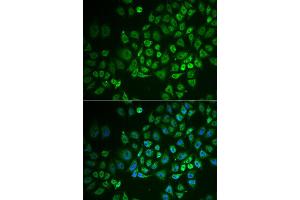 Immunofluorescence analysis of A549 cell using GPLD1 antibody. (GPLD1 Antikörper)