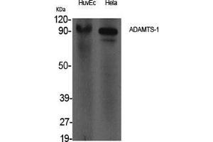 Western Blot (WB) analysis of specific cells using ADAMTS-1 Polyclonal Antibody. (ADAMTS1 Antikörper  (Internal Region))