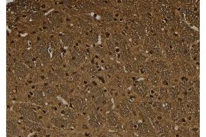 ABIN6274032 at 1/100 staining Rat brain tissue by IHC-P. (HSF1 Antikörper  (pSer326))