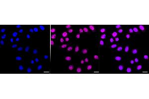 Immunocytochemical staining of HepG2 cells with Chromodomain helicase DNA binding protein 4 antibody (ABIN7800918), 1:1,000). (Rekombinanter Chromodomain Helicase DNA Binding 4 Antikörper)