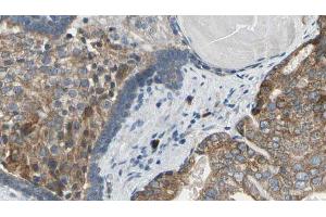 ABIN6269351 at 1/100 staining Human prostate tissue by IHC-P. (eIF4EBP1 Antikörper  (Internal Region))