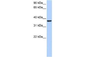 WB Suggested Anti-HMG20B Antibody Titration:  0. (HMG20B Antikörper  (Middle Region))
