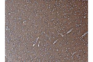 IHC analysis of NSF using anti-NSF antibody (ABIN7601630). (NSF Antikörper  (AA 4-636))