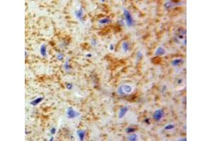 Used in DAB staining on fromalin fixed paraffin-embedded Brain tissue (CCL20 Antikörper  (AA 24-95))