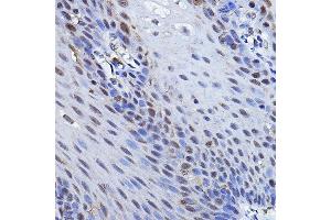 Immunohistochemistry of paraffin-embedded human esophageal using TP73 Rabbit pAb (ABIN6133470, ABIN6149430, ABIN6149431 and ABIN6213831) at dilution of 1:100 (40x lens). (Tumor Protein p73 Antikörper  (AA 1-100))