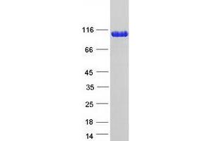 Western Blotting (WB) image for Tripartite Motif Containing 28 (TRIM28) protein (Myc-DYKDDDDK Tag) (ABIN2733715)
