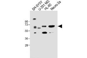 All lanes : Anti-CERK Antibody (C-term) at 1:1000 dilution Lane 1: SH-SY5Y whole cell lysate Lane 2: U-251 MG whole cell lysate Lane 3: HL-60 whole cell lysate Lane 4: Neuro-2a whole cell lysate Lysates/proteins at 20 μg per lane. (CERK Antikörper  (C-Term))