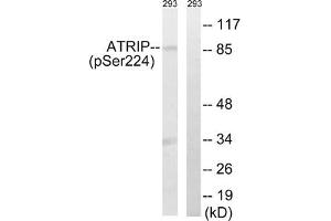 Western blot analysis of extracts from 292 cells, treated with UV (15 mins), using ATRIP (Phospho-Ser224) antibody. (ATRIP Antikörper  (pSer224))