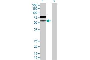Western Blot analysis of BLNK expression in transfected 293T cell line by BLNK MaxPab polyclonal antibody. (B-Cell Linker Antikörper  (AA 1-456))