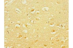 Immunohistochemistry of paraffin-embedded human brain tissue using ABIN7166564 at dilution of 1:100 (PCDH19 Antikörper  (AA 568-678))