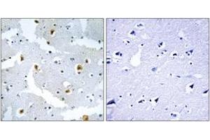Immunohistochemistry analysis of paraffin-embedded human brain tissue, using FMN2 Antibody. (Formin 2 Antikörper  (AA 1541-1590))