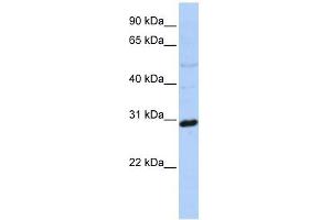 Metaxin 2 antibody used at 1 ug/ml to detect target protein. (MTX2 Antikörper  (N-Term))
