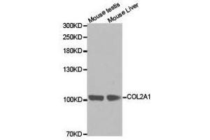 Western Blotting (WB) image for anti-Collagen, Type II, alpha 1 (COL2A1) antibody (ABIN1871948) (COL2A1 Antikörper)