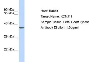 Host: Rabbit Target Name: KCNJ11 Sample Type: Fetal Heart lysates Antibody Dilution: 1. (KCNJ11 Antikörper  (Middle Region))