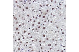 Immunohistochemistry of paraffin-embedded rat liver using MED4 Rabbit mAb (ABIN7268445) at dilution of 1:100 (40x lens). (MED4 Antikörper)