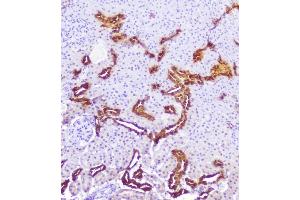 IHC analysis of Calbindin using anti-Calbindin antibody (ABIN6719541). (CALB1 Antikörper  (AA 2-261))