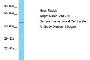 Host: Rabbit Target Name: ZNF736 Sample Type: Jurkat Whole Cell lysates Antibody Dilution: 1. (ZNF736 Antikörper  (N-Term))