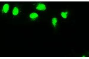 Anti-MAP2K4 mouse monoclonal antibody (ABIN2452439) immunofluorescent staining of COS7 cells transiently transfected by pCMV6-ENTRY MAP2K4 (RC206051). (MAP2K4 Antikörper)
