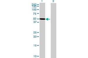 Western Blot analysis of ZNF689 expression in transfected 293T cell line by ZNF689 MaxPab polyclonal antibody. (ZNF689 Antikörper  (AA 1-500))