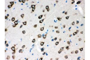 Anti- SMN1/2 Picoband antibody,IHC(P) IHC(P): Rat Brain Tissue (SMN1 / SMN2 (AA 22-52), (N-Term) Antikörper)