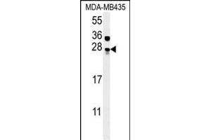 MUTED Antibody (Center) (ABIN654098 and ABIN2843982) western blot analysis in MDA-M cell line lysates (15 μg/lane).