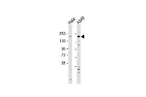 All lanes : Anti-IGF1R Antibody at 1:2000 dilution Lane 1: Hela whole cell lysate Lane 2: A549 whole cell lysate Lysates/proteins at 20 μg per lane. (IGF1R Antikörper  (N-Term))