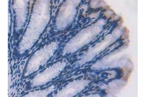 Immunohistochemistry (IHC) image for anti-Adenosine Kinase (ADK) (AA 1-361) antibody (ABIN7440812)