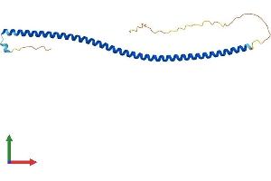 Protein Structure (PS) image for Coiled-Coil Domain Containing 85B (CCDC85B) (AA 1-202) protein (His tag) (ABIN7558053)