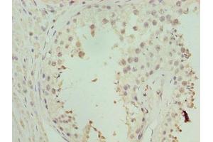 Immunohistochemistry of paraffin-embedded human testis tissue using ABIN7176343 at dilution of 1:100 (ZNF546 Antikörper  (AA 101-400))