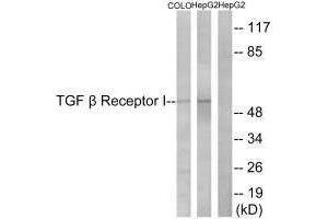 Western blot analysis of extracts from COLO cells and HepG2 cells, using TGF β Receptor I (Ab-165) antibody. (TGFBR1 Antikörper  (Ser165))