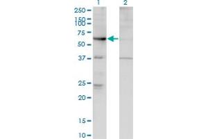 Western Blot analysis of ARHGEF5 expression in transfected 293T cell line by ARHGEF5 monoclonal antibody (M02), clone 4D10-D11.