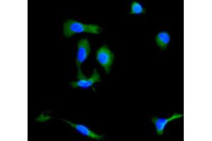 Immunocytochemistry analysis of Mouse MSC cells using Ly-6G Antibody. (Ly6g Antikörper)