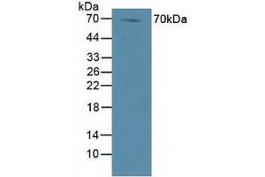 Figure. (DVL1 Antikörper  (AA 150-285))