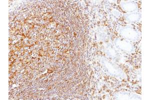 IHC-P Image Immunohistochemical analysis of paraffin-embedded human gastric N+T, using LBP, antibody at 1:100 dilution.