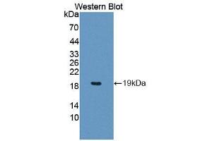 Western blot analysis of the recombinant protein. (PCCA Antikörper  (AA 580-728))